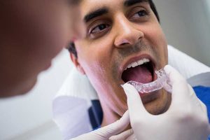 Invisalign Vancouver