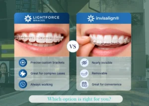 LightForce braces vs Invisalign comparison at O2 Dental Vancouver