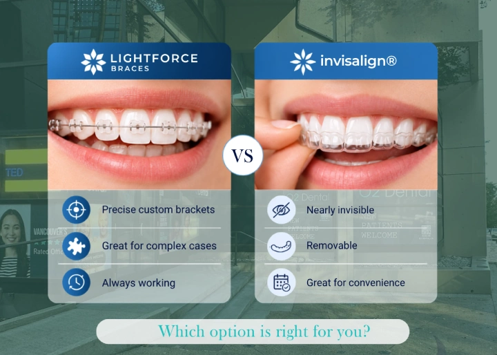 LightForce braces vs Invisalign comparison at O2 Dental Vancouver