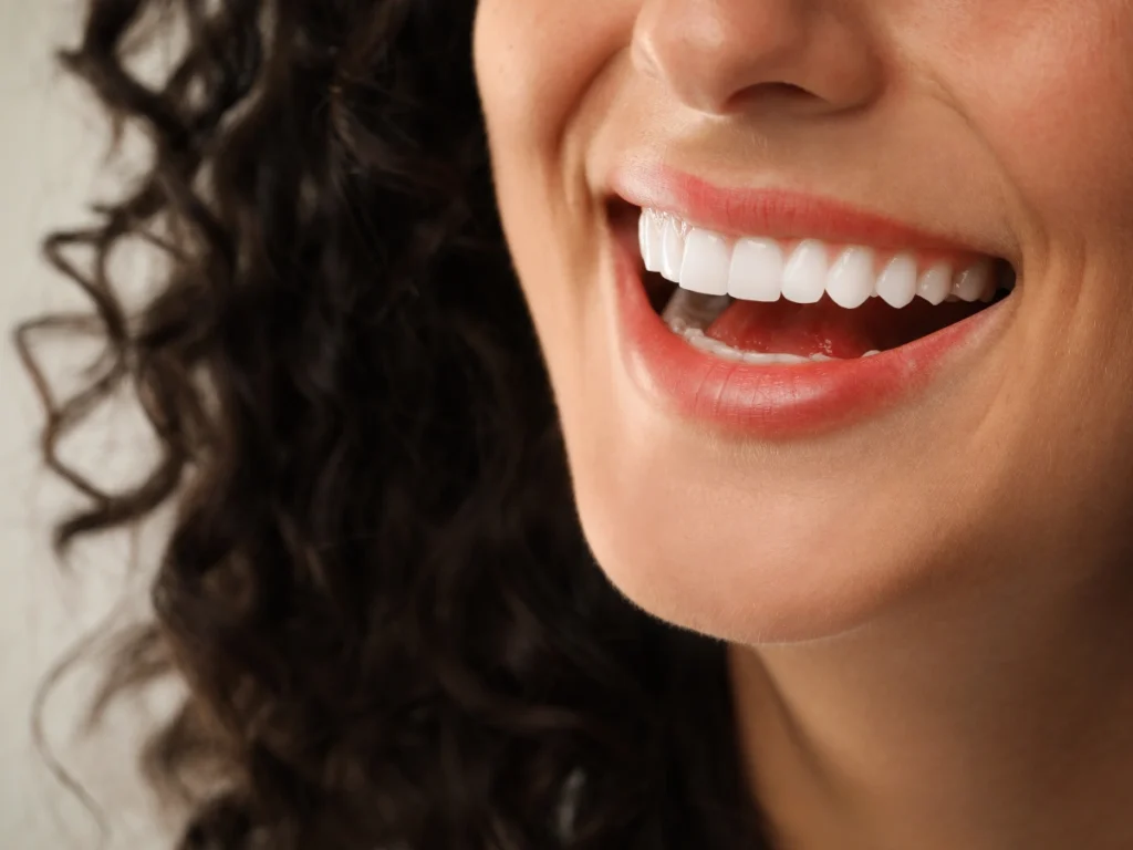 Porcelain veneers smile transformation at O2 Dental Vancouver